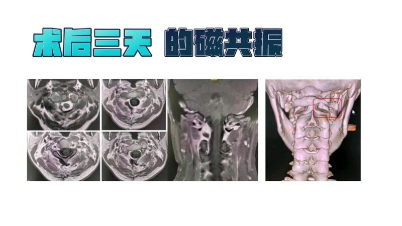 視頻封面