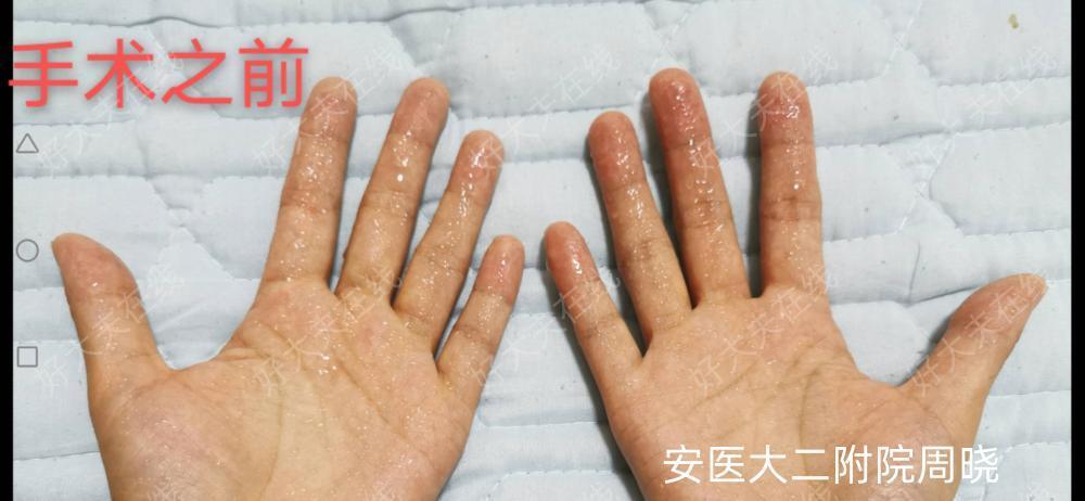圖文圖片