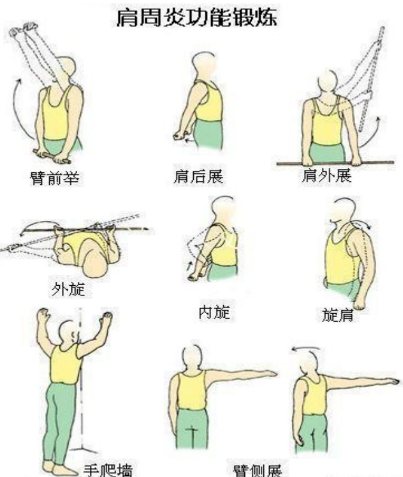 得了冻结肩该如何治疗?_肩周炎 - 好大夫在线