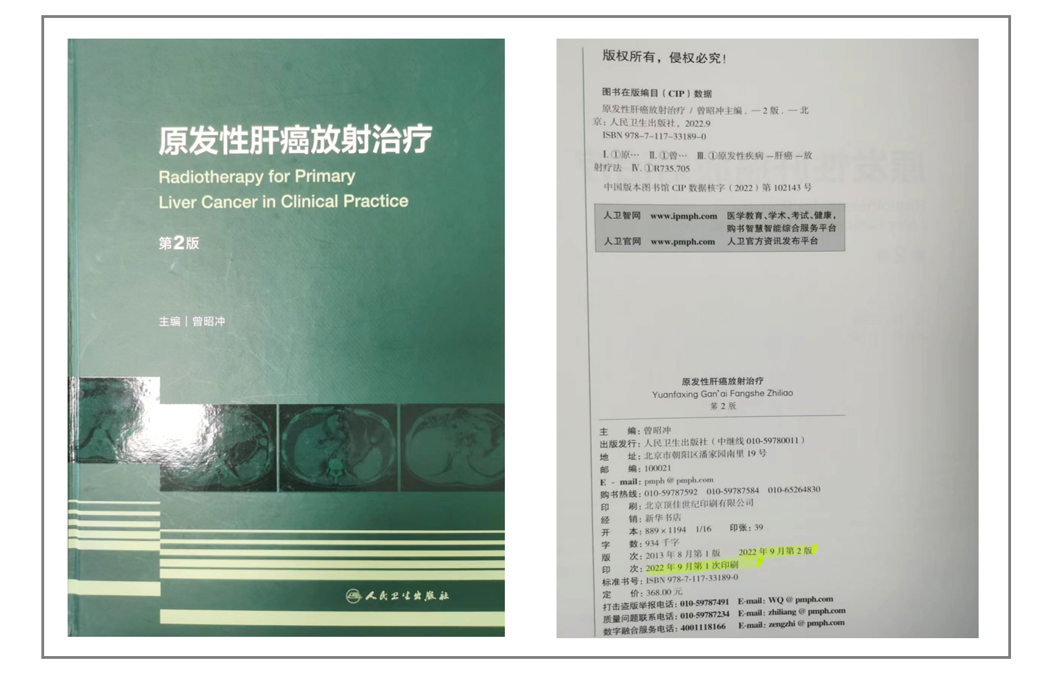 1例（男/56岁）肝内胆管细胞癌以局部治疗为先导的综合治疗-iSABR-5D TOMO放疗_肝内胆管癌_肝内胆管癌治疗方式 - 好大夫在线
