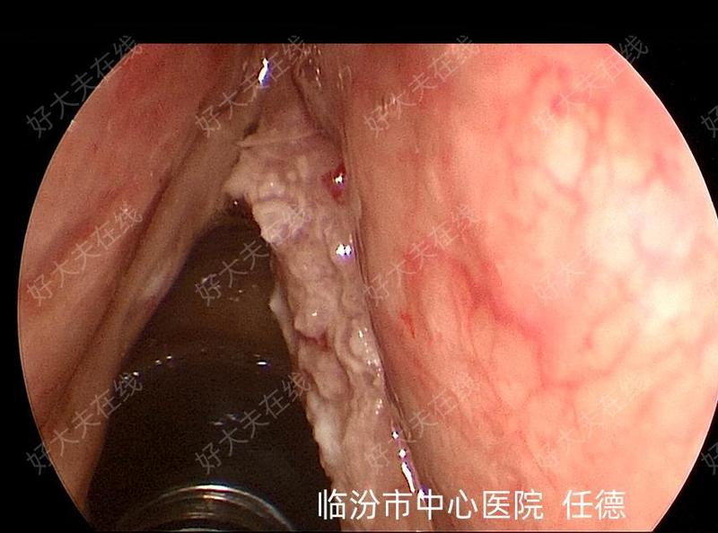 圖文圖片