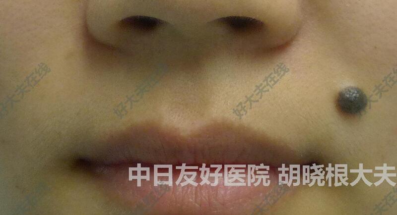 圖文圖片