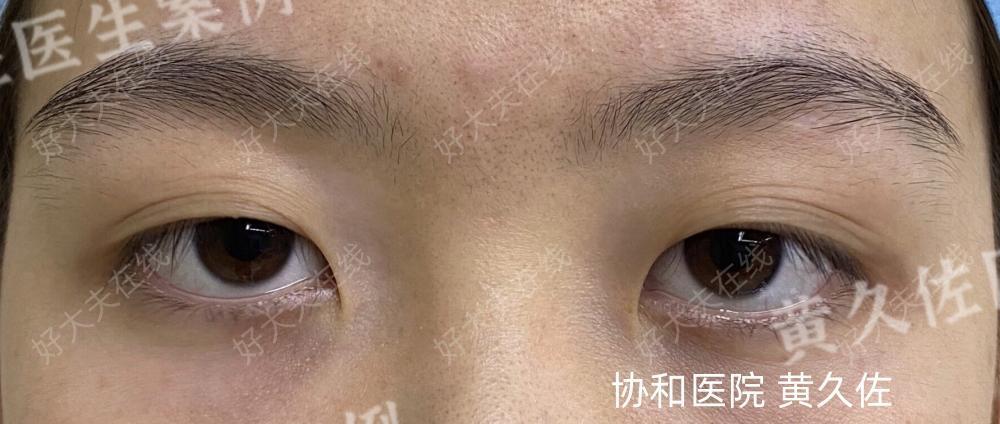 圖文圖片
