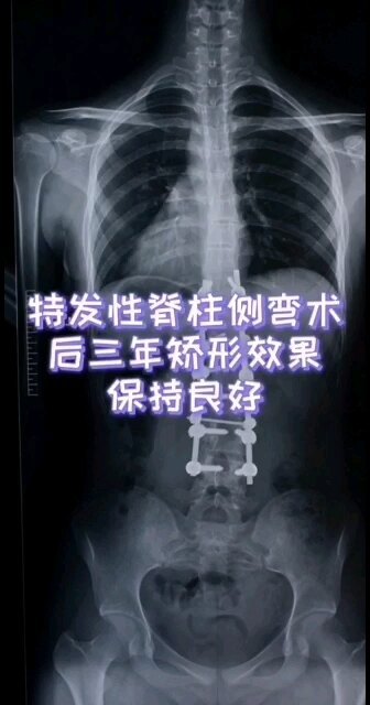 視頻封面