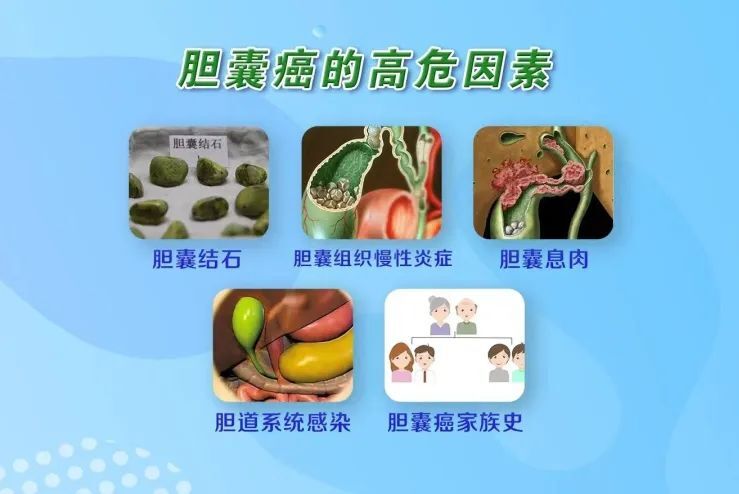 圖文圖片