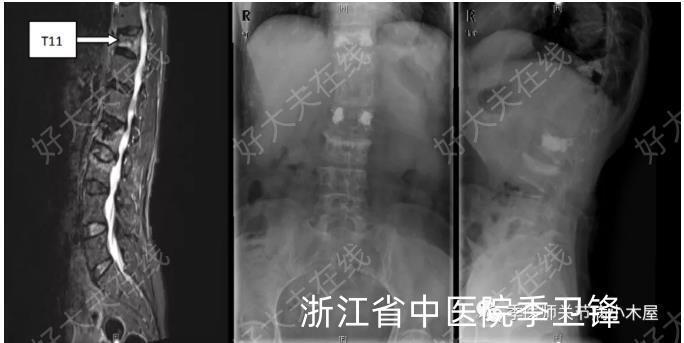 圖文圖片