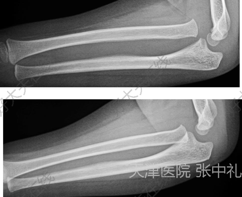 圖文圖片