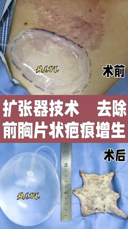 視頻封面