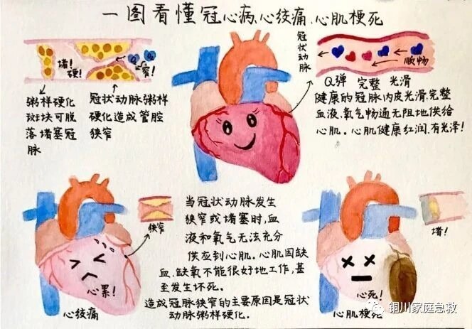 心脏病是怎么引起的图片