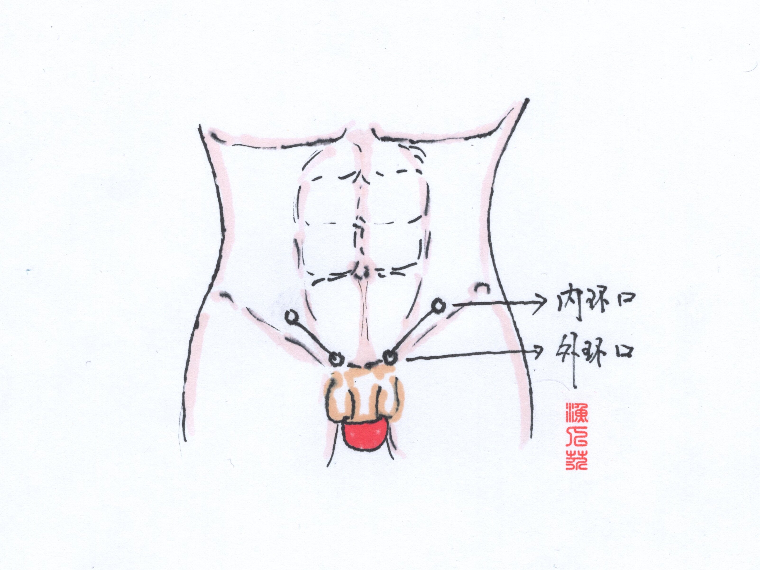 腹股沟外环图片