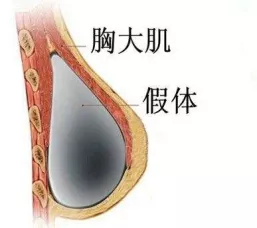 圖文圖片