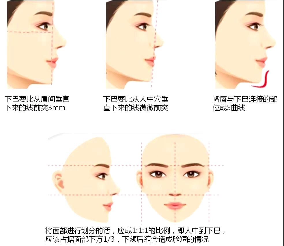 下巴塑形怎么选_隆下颏_隆下颏治疗介绍 - 好大夫在线