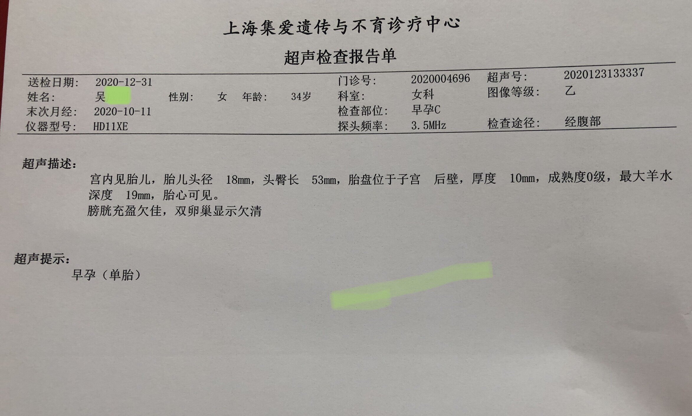 输卵管结扎术后妊娠案例 - 好大夫在线