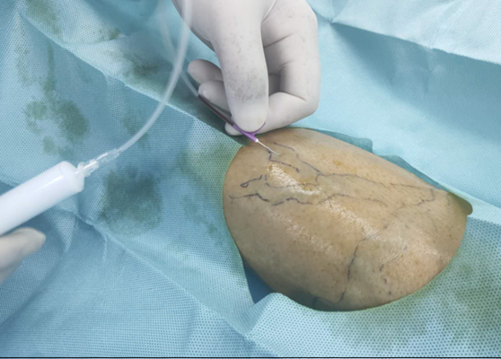 血管为什么是青色的