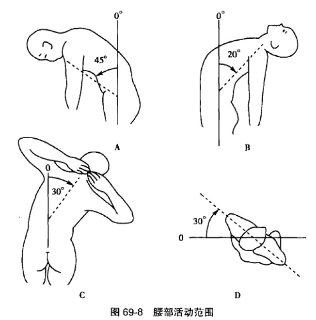 腰椎间盘突出_相关疾病_介绍 - 好大夫在线