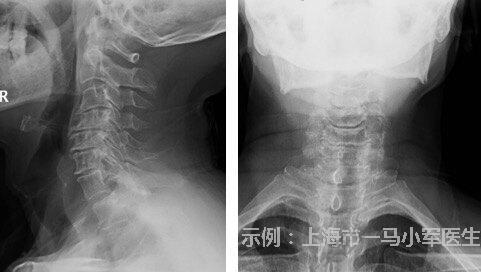 圖文圖片