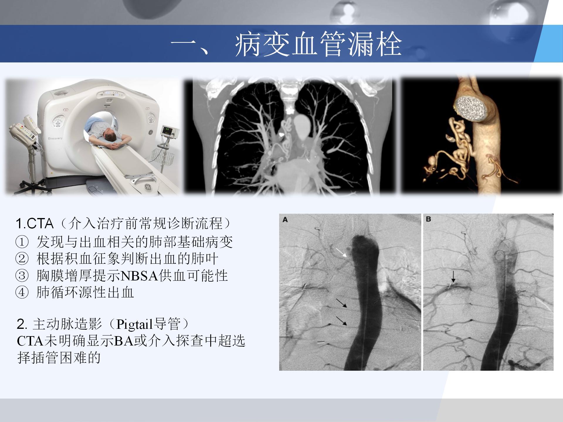 广医附一院-咯血病例汇报 [自动保存的]_14.jpg