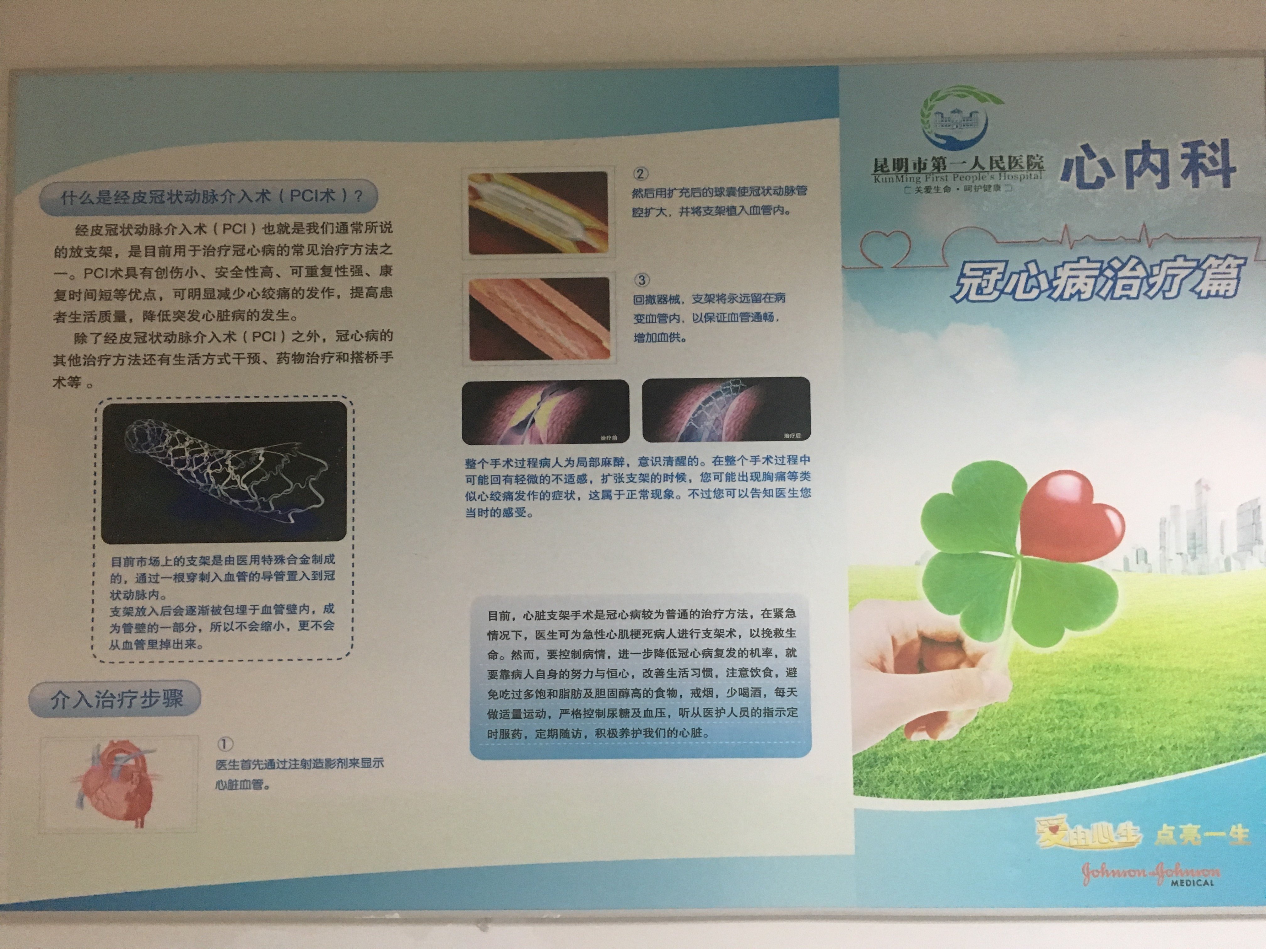 冠心病的治疗方法_冠心病_治疗方法_治疗方式 - 好大夫在线