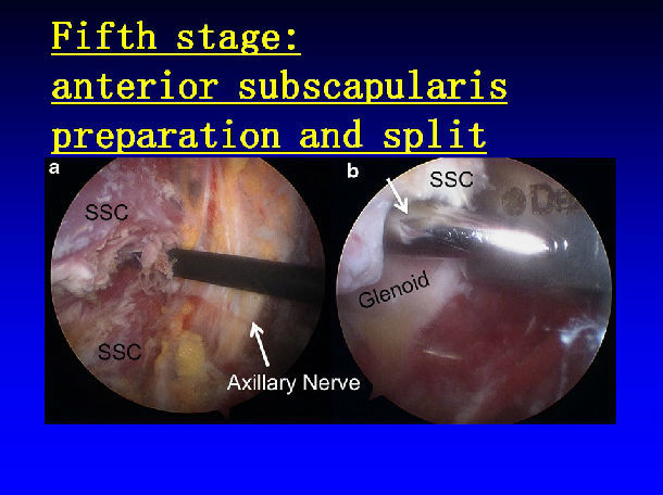 高绪仁2014年徐医附院腔镜技术论坛