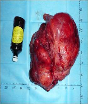 duang!并不罕见的"罕见病"——软组织肿瘤