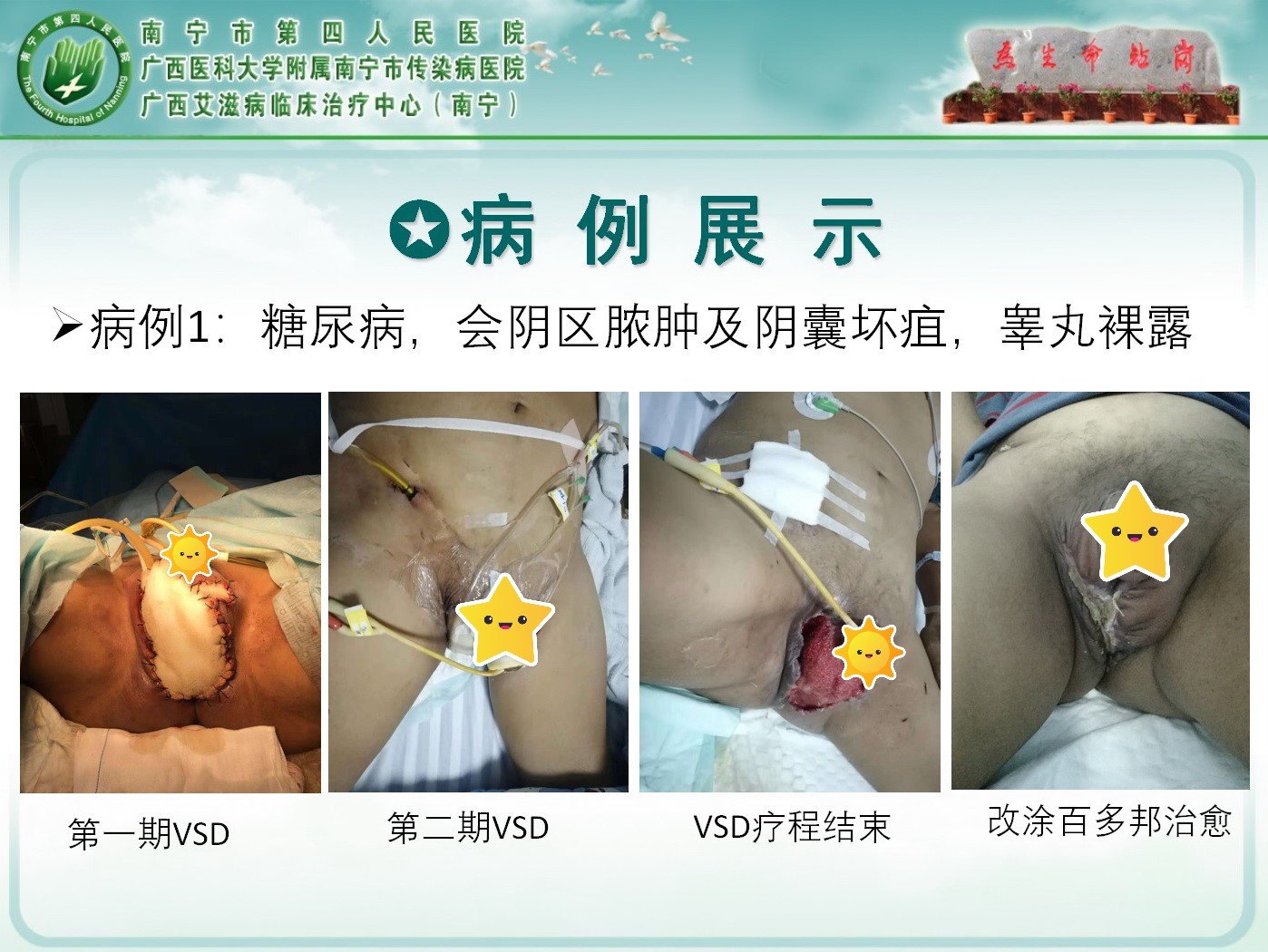 暂无