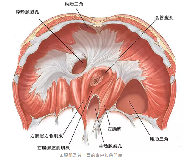 食管裂孔疝