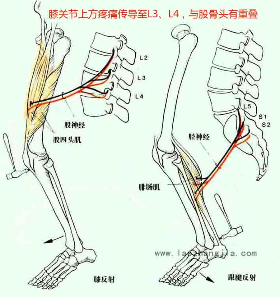 > 当心腰痛,膝盖痛也可能是股骨头坏死的先兆