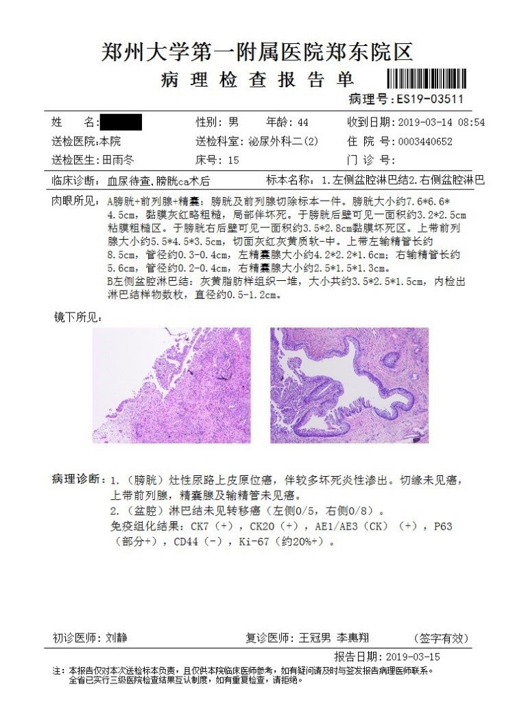 膀胱癌 病理报告图片