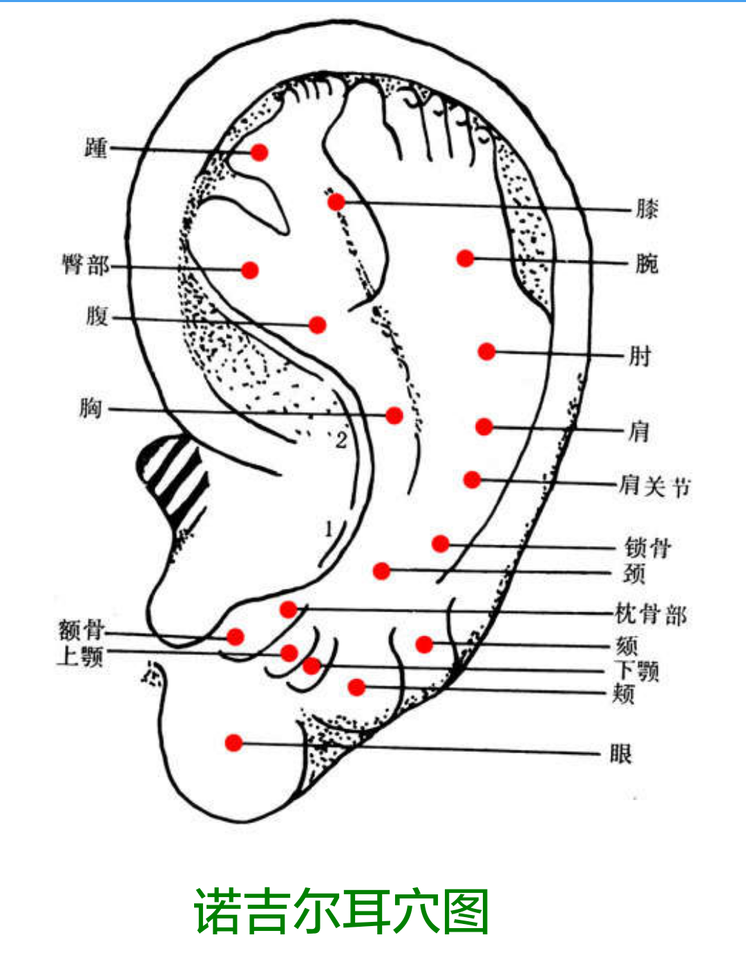 针刺运动疗法·耳穴