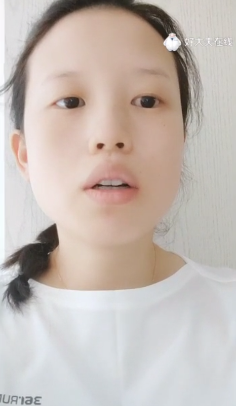 胆汁酸高对胎儿有什么影响？