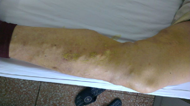 图解周围血管病 - 好大夫在线