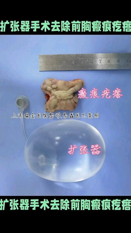 視頻封面
