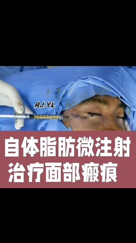 視頻封面