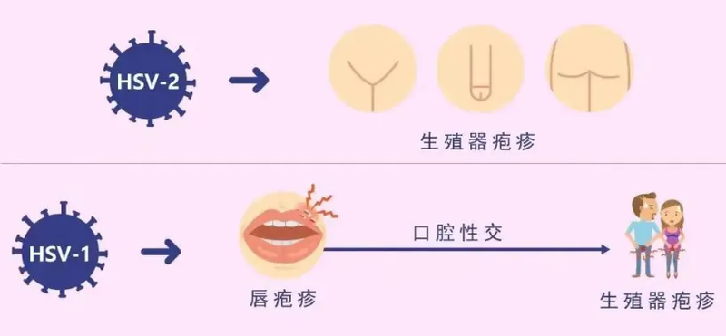 圖文圖片