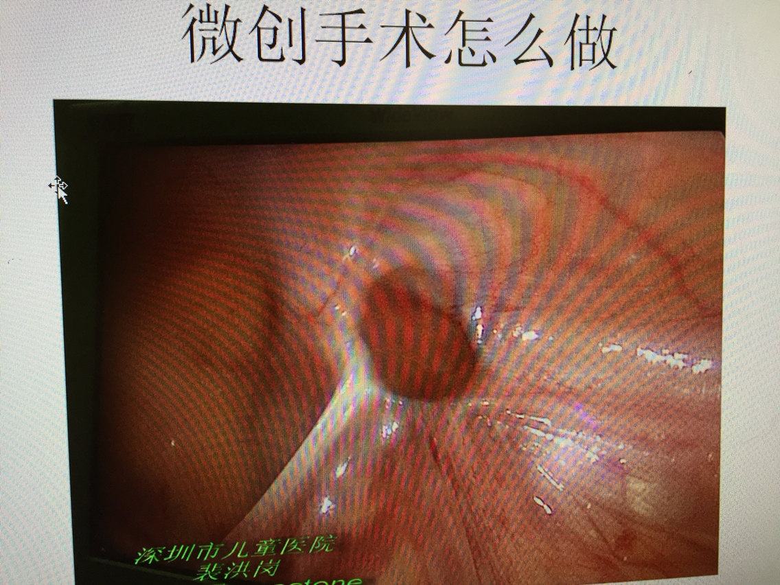暂无