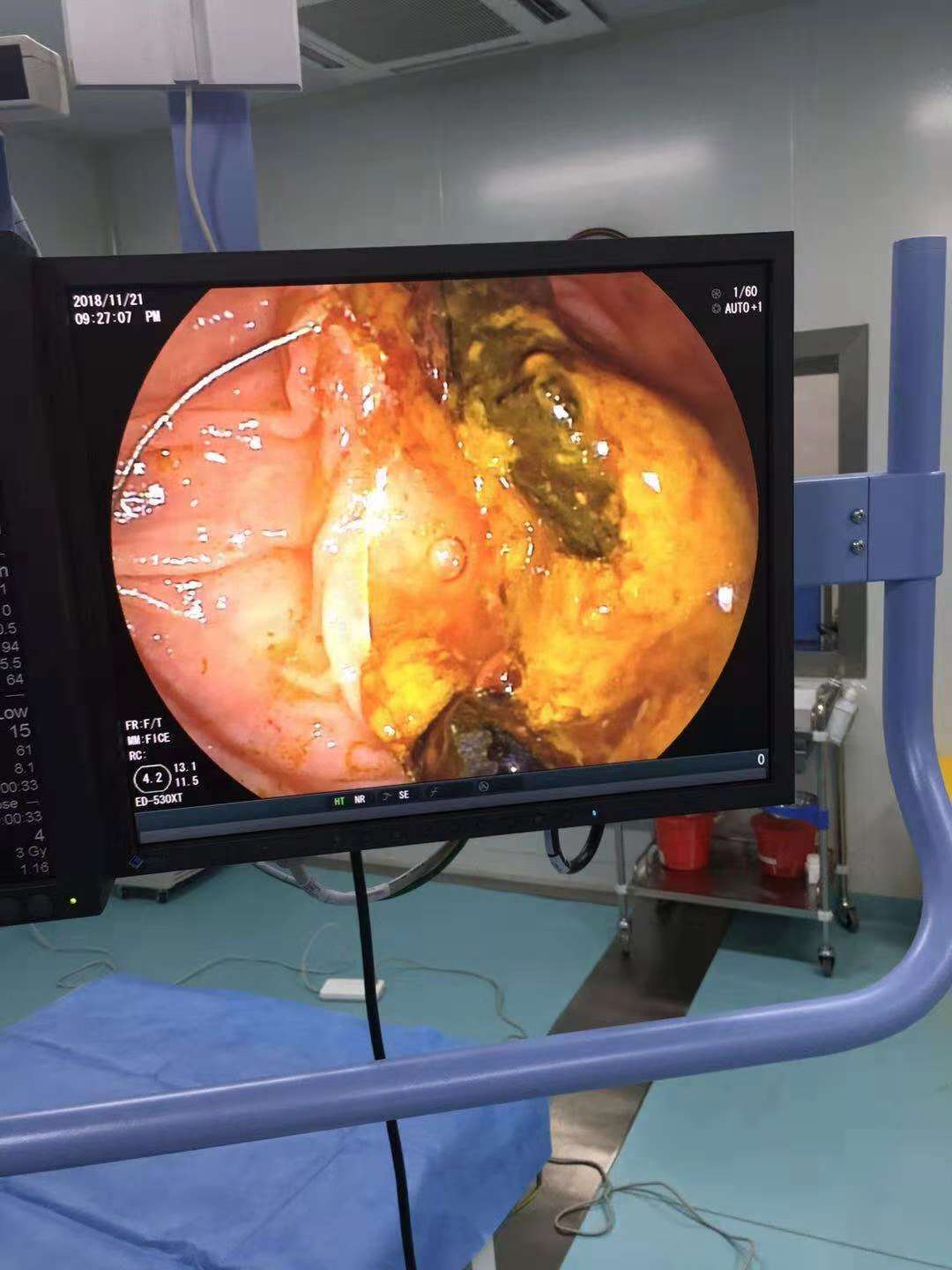 本文是李双全版权所有,未经授权请勿转载.