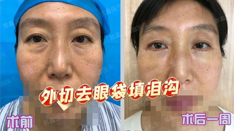 視頻封面