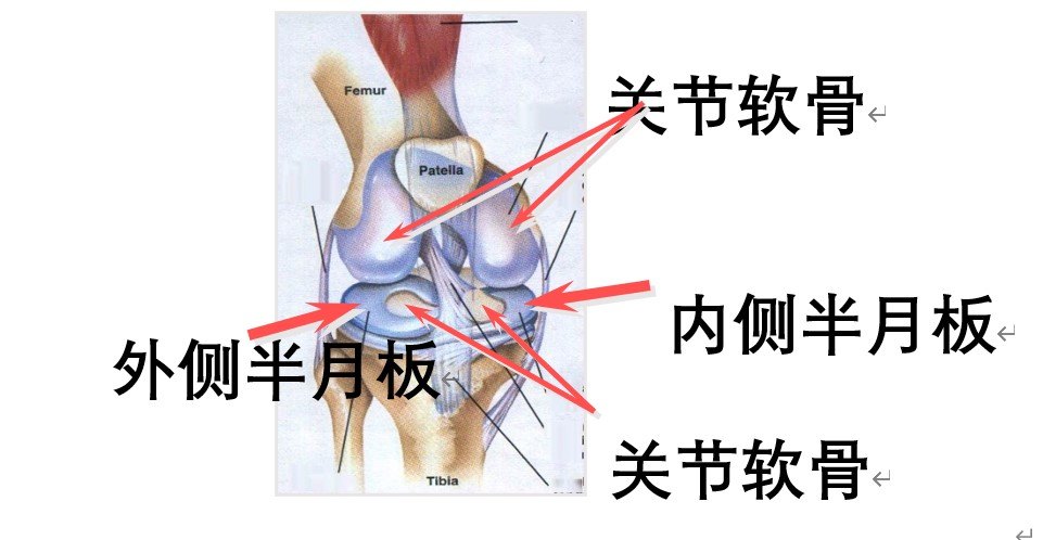软骨,关节囊等组成关节的常规结构外,还有前后交叉韧带,内外侧副韧带