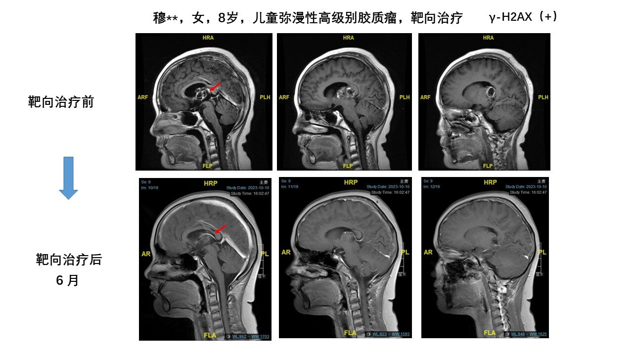 矢状位.jpg