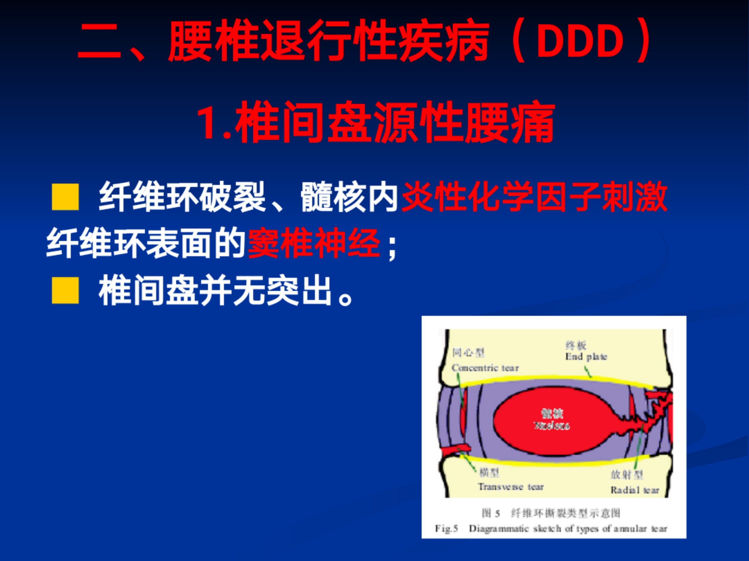 浅谈腰痛(1)_21.jpg