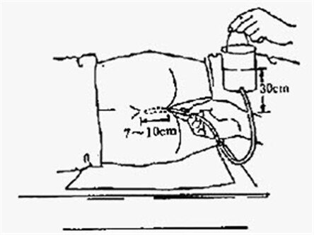 给老年人灌肠,这些事项要做到位,不要到时候再后悔!