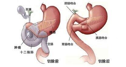 圖文圖片