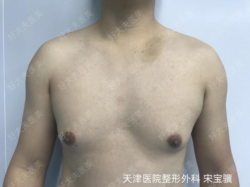 圖文圖片