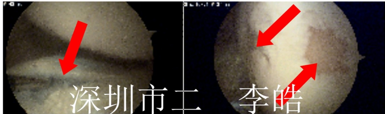 Screenshot_20200622_202539_com.ny.jiuyi160_doctor.png