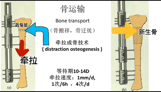 默认图片