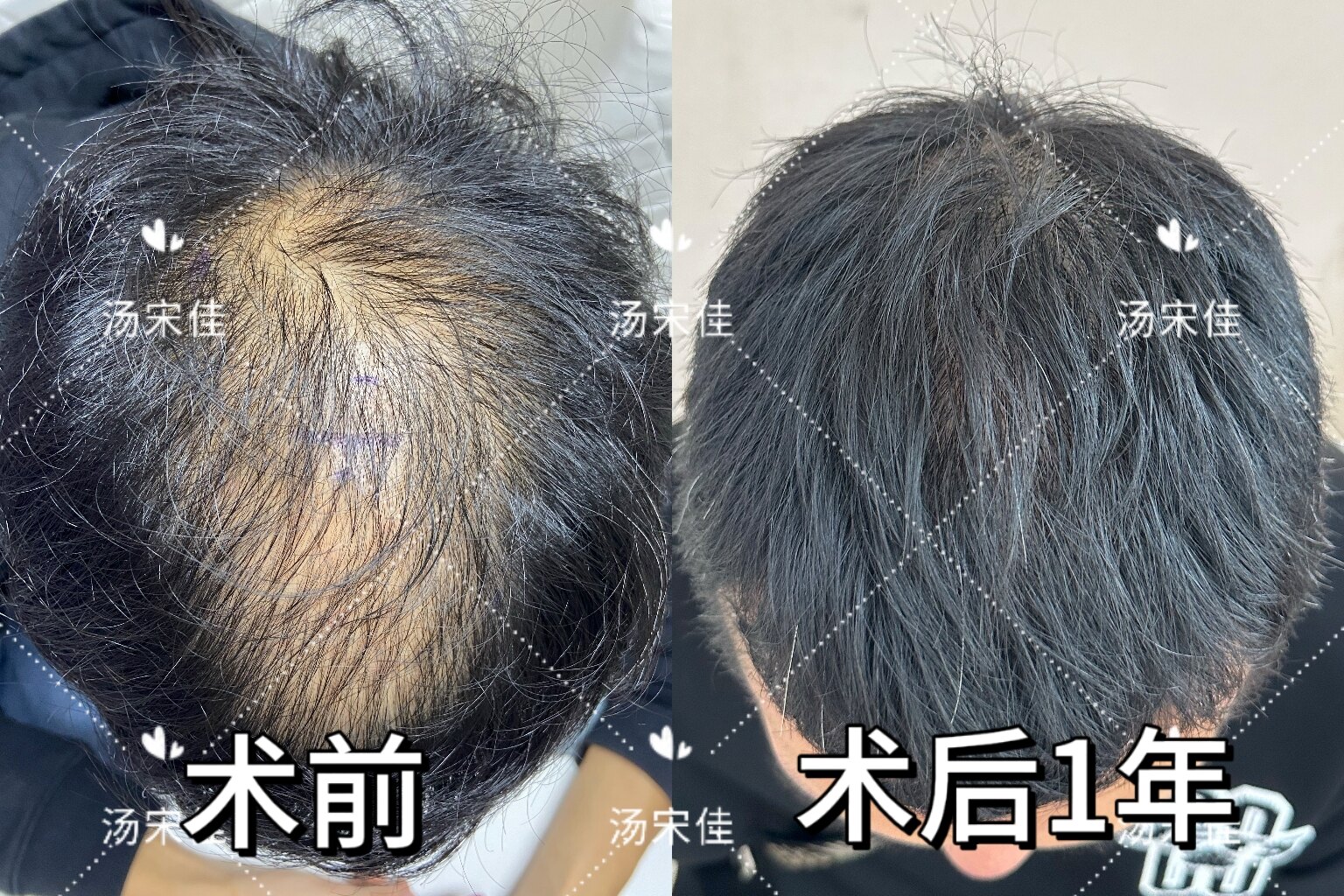 圖文圖片