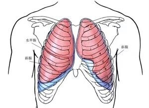 胸腔体表定位及胸腔积液量评估 - 好大夫在线