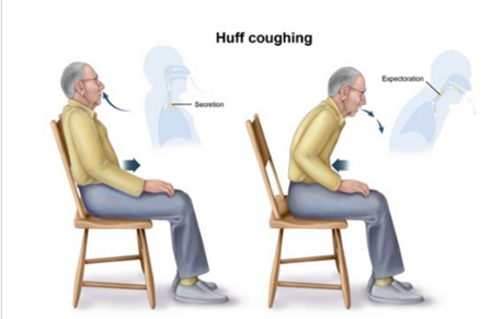 咳嗽排痰的时候,要采取半卧位或坐位,上半身前倾,肩膀放松,用力深呼吸