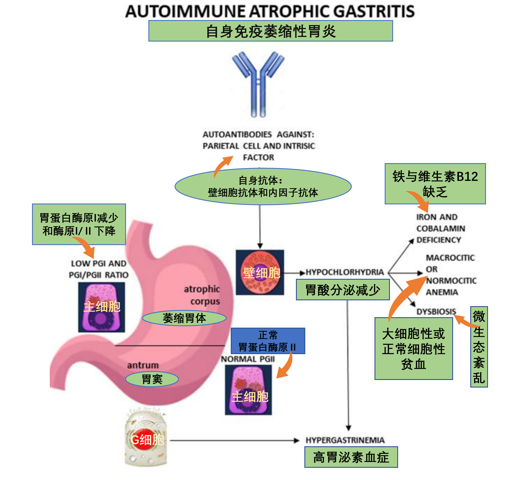 自免胃炎机制图.png