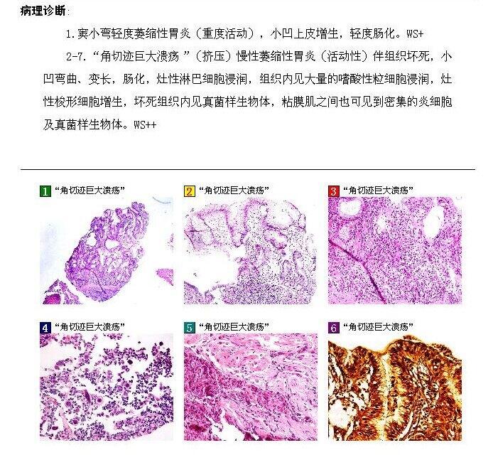 王和平1病理.jpg